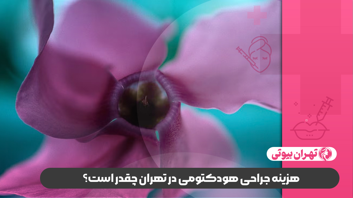 10 بهترین دکتر عمل هودکتومی در تهران