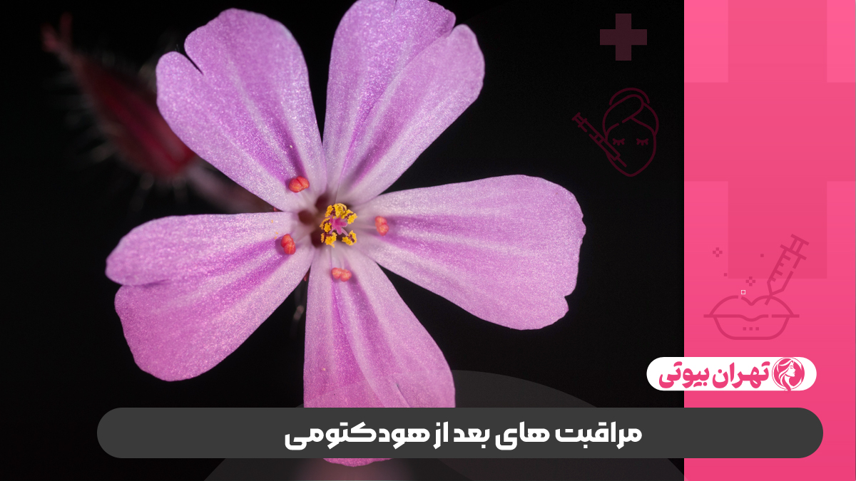 10 بهترین دکتر عمل هودکتومی در تهران