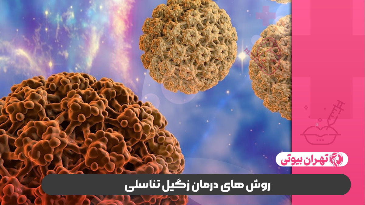 10 بهترین متخصص درمان زگیل تناسلی در تهران