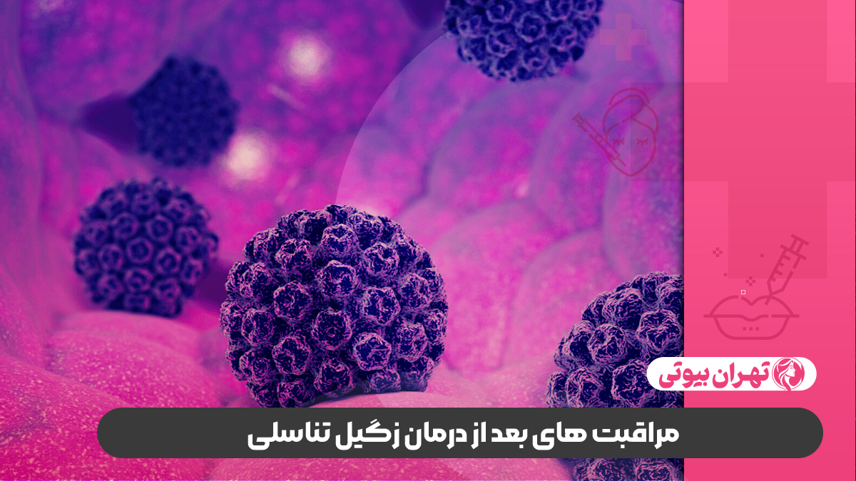10 بهترین متخصص درمان زگیل تناسلی در تهران