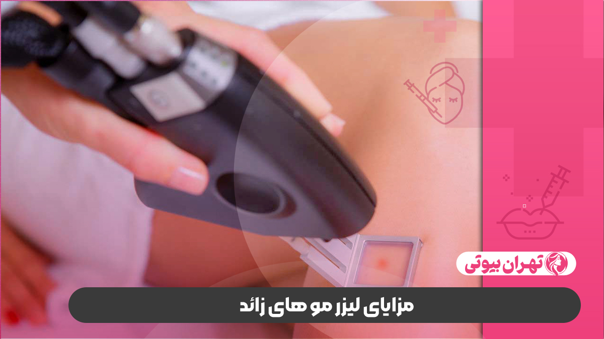 10 بهترین مرکز لیزر موهای زائد در تهران
