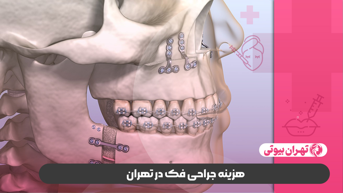 10 بهترین جراح فک و صورت در تهران