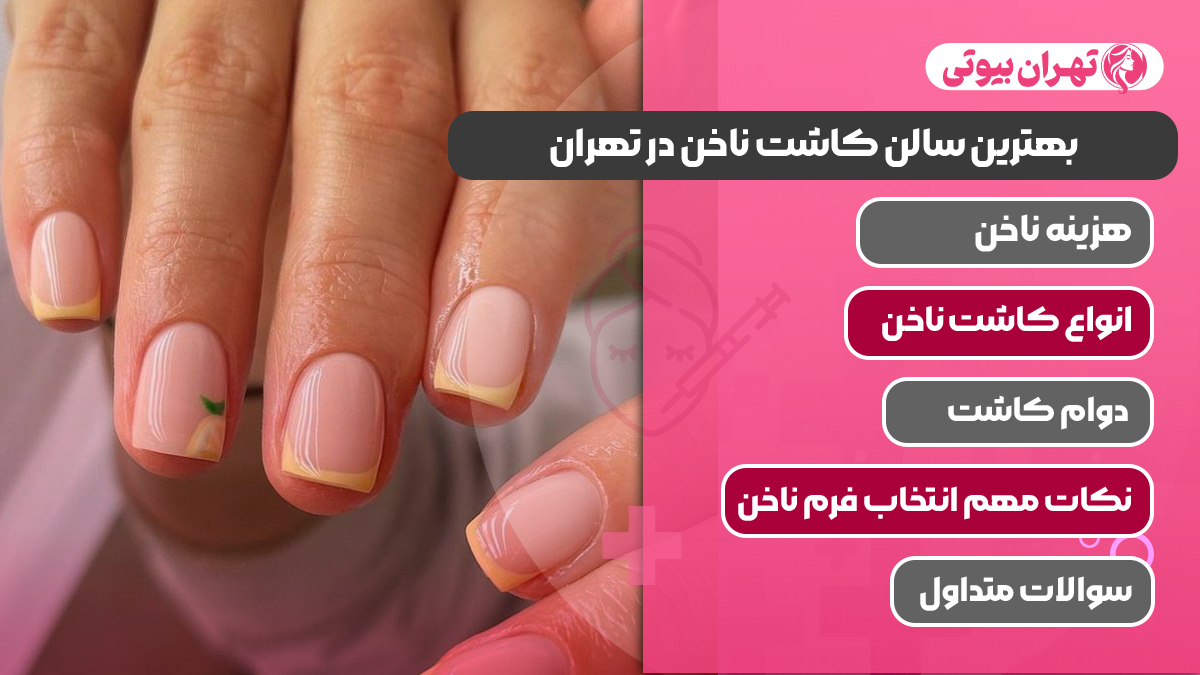 10 بهترین سالن کاشت ناخن در تهران
