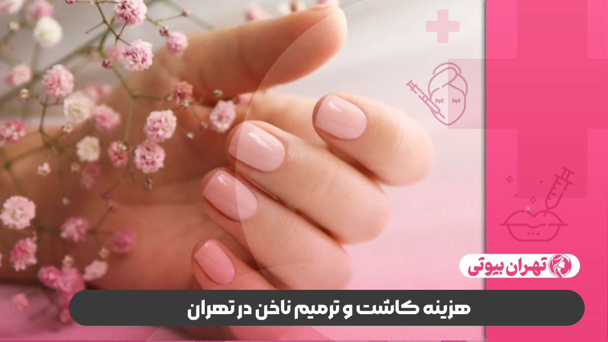 10 بهترین سالن کاشت ناخن در تهران