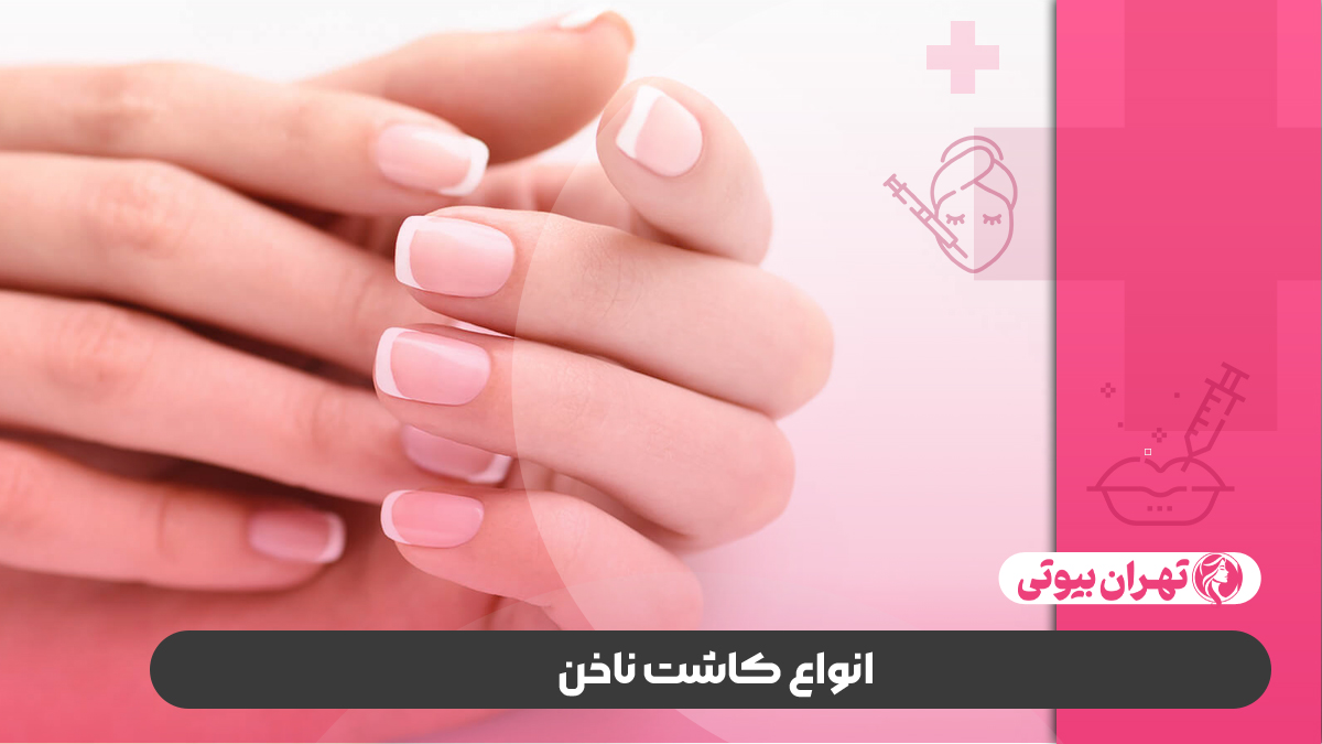 10 بهترین سالن کاشت ناخن در تهران