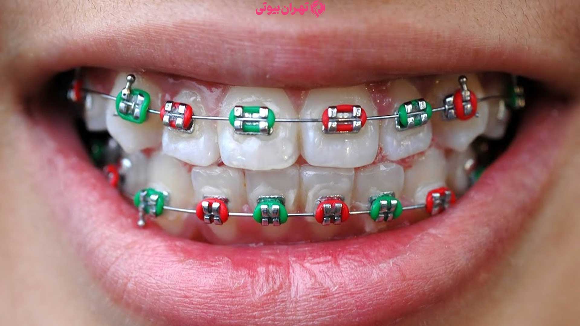 10 بهترین دکتر ارتودنسی در تهران