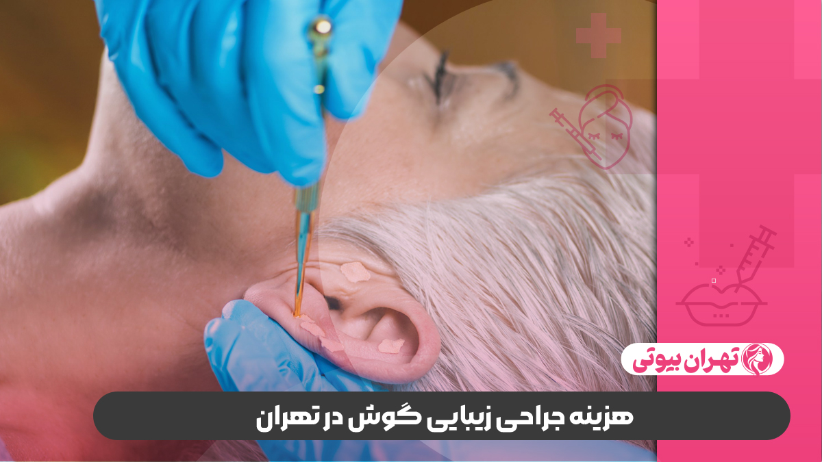 10 بهترین دکتر جراحی زیبایی گوش (اتوپلاستی) در تهران