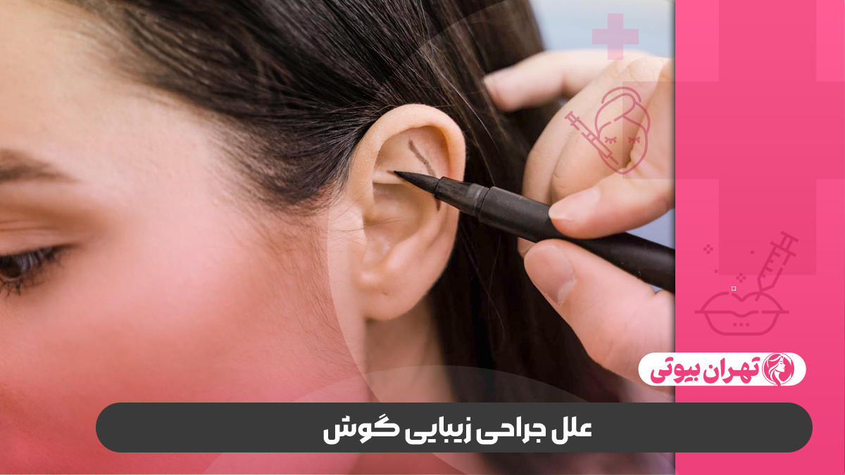 10 بهترین دکتر جراحی زیبایی گوش (اتوپلاستی) در تهران