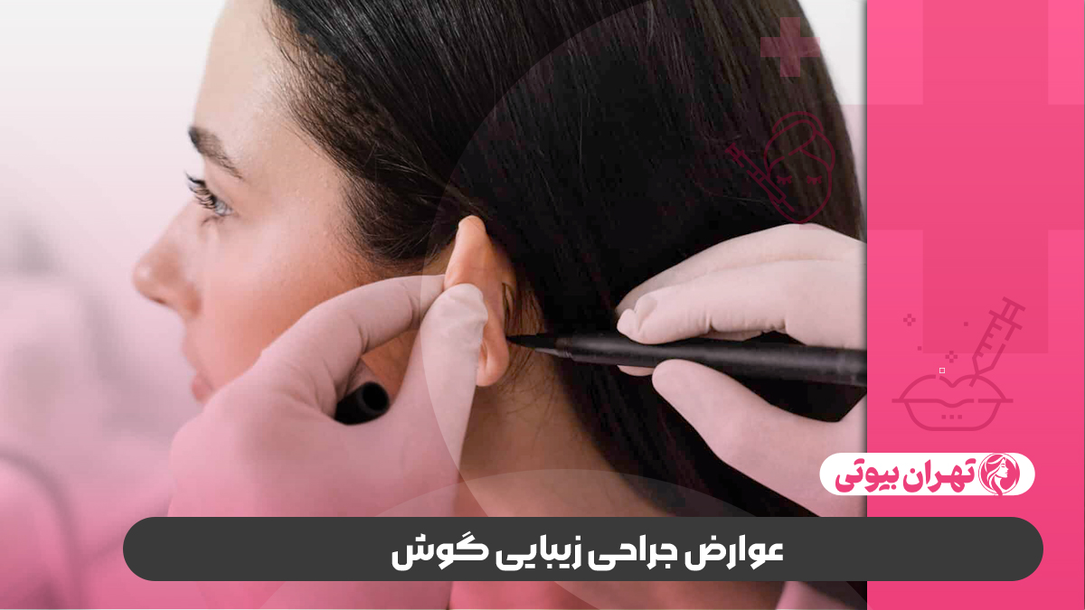 10 بهترین دکتر جراحی زیبایی گوش (اتوپلاستی) در تهران