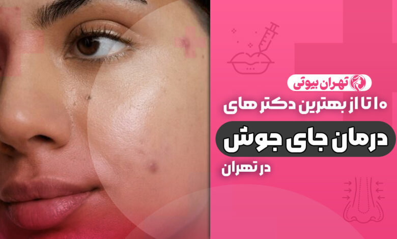 10 بهترین دکتر درمان جای جوش در تهران