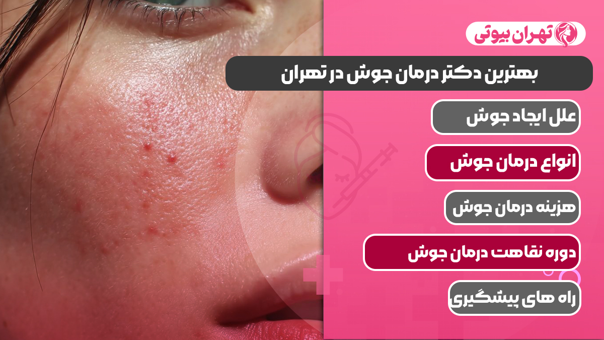 10 بهترین دکتر درمان جوش در تهران