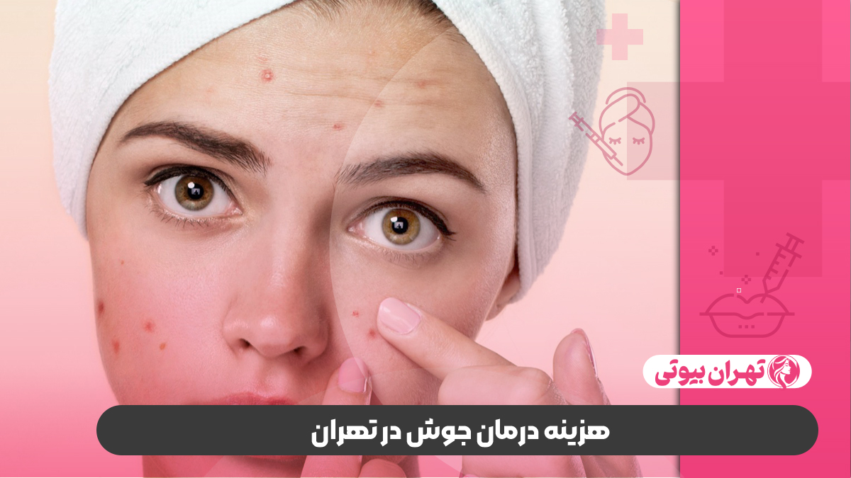 10 بهترین دکتر درمان جوش در تهران
