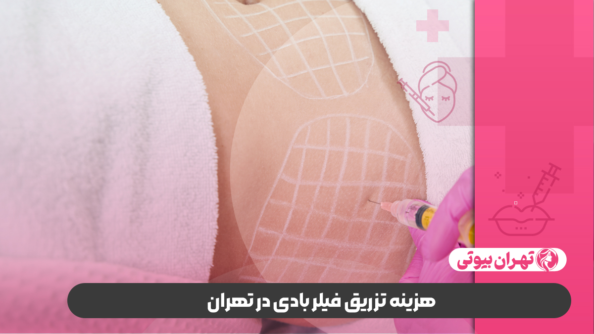10 بهترین دکتر تزریق فیلر بادی در تهران