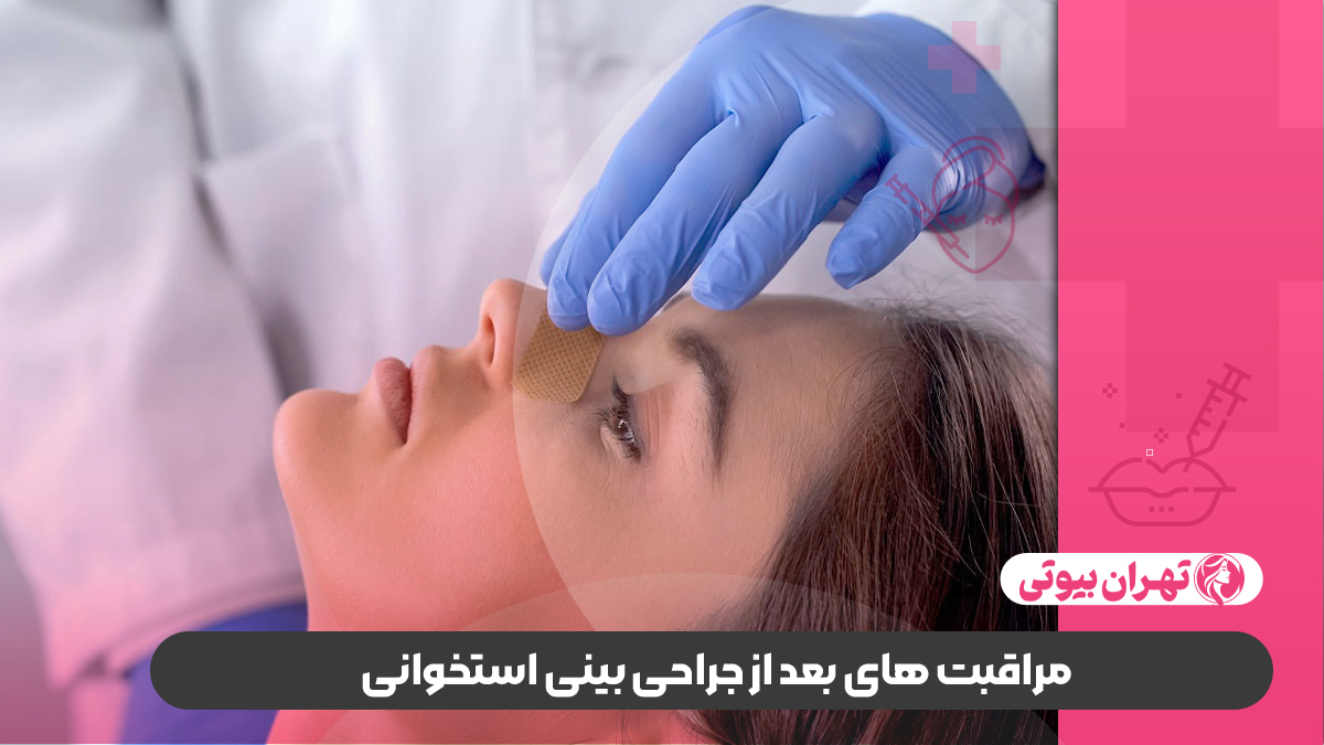 10 بهترین جراح بینی استخوانی در تهران