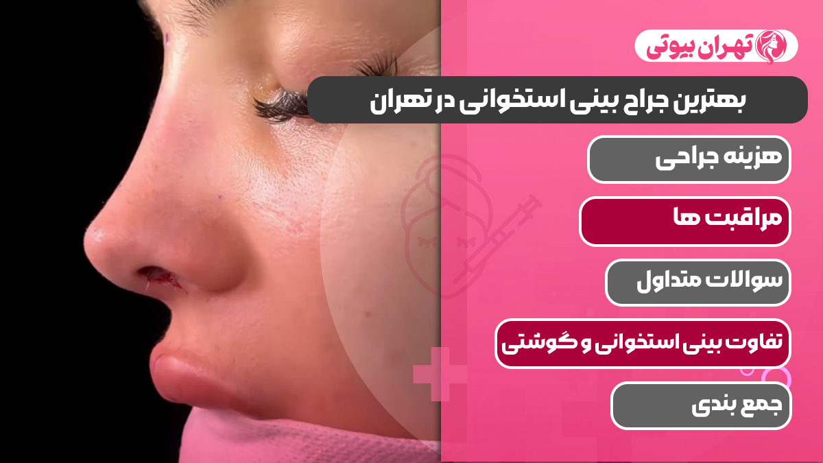 10 بهترین جراح بینی استخوانی در تهران