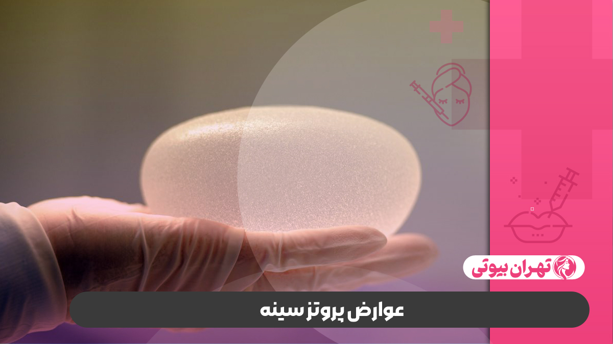 10 بهترین جراح پروتز سینه در تهران