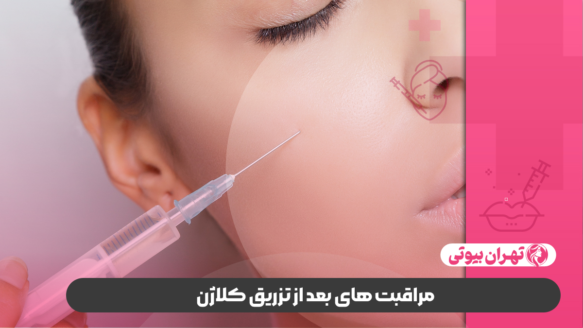 10 بهترین دکتر تزریق کلاژن در تهران
