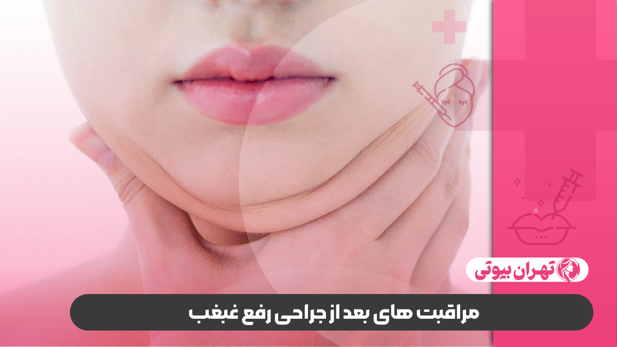 10 بهترین دکتر رفع غبغب در تهران