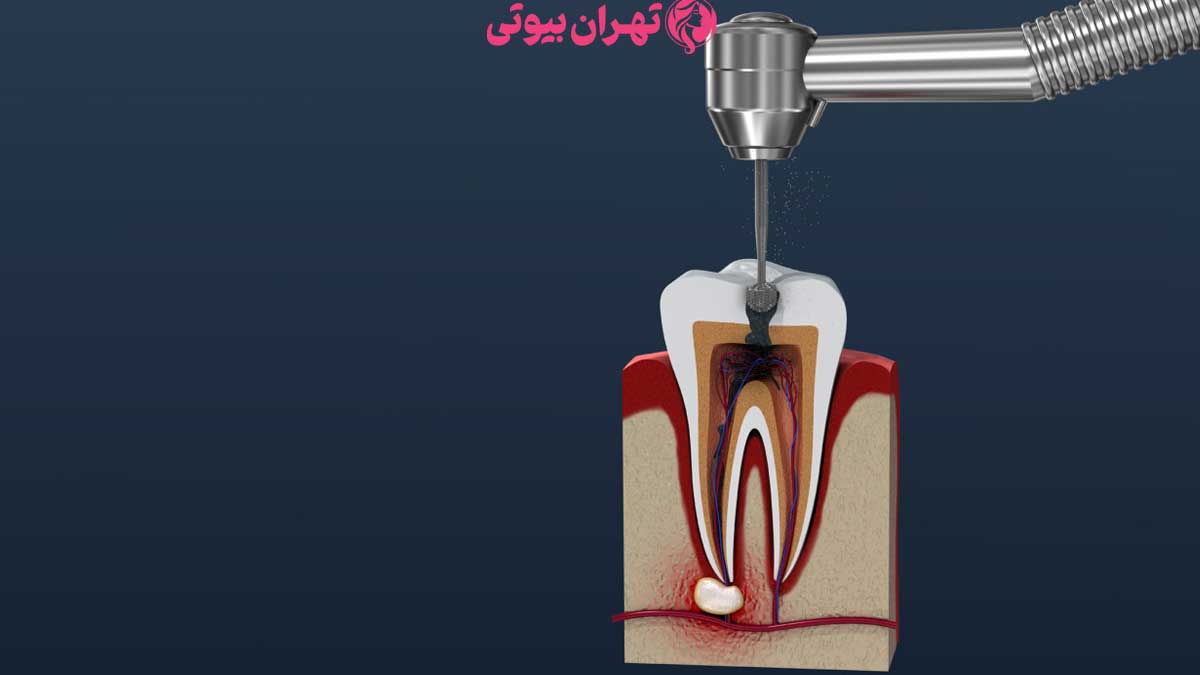 10 بهترین متخصص درمان ریشه در تهران