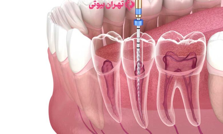 10 بهترین متخصص درمان ریشه در تهران