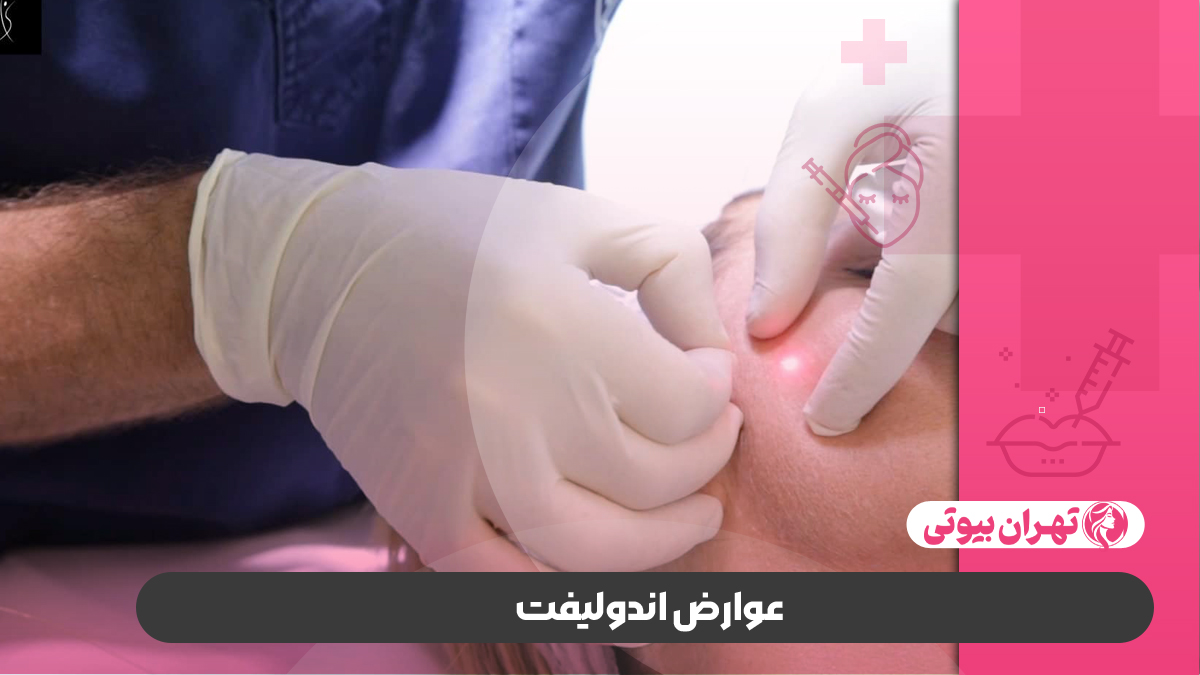 10 بهترین دکتر اندولیفت در تهران