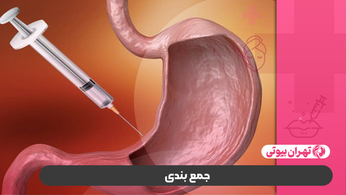 10 بهترین دکتر بوتاکس معده در تهران