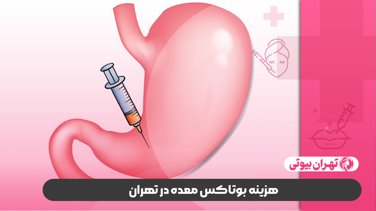 10 بهترین دکتر بوتاکس معده در تهران
