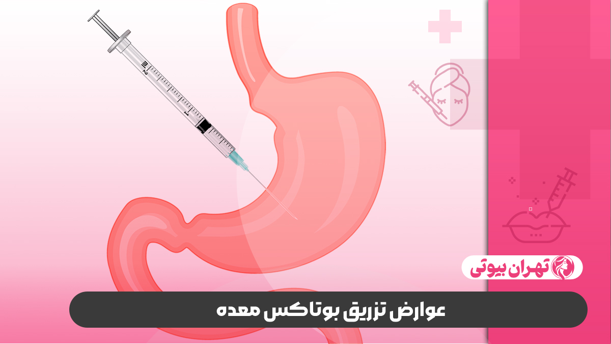 10 بهترین دکتر بوتاکس معده در تهران