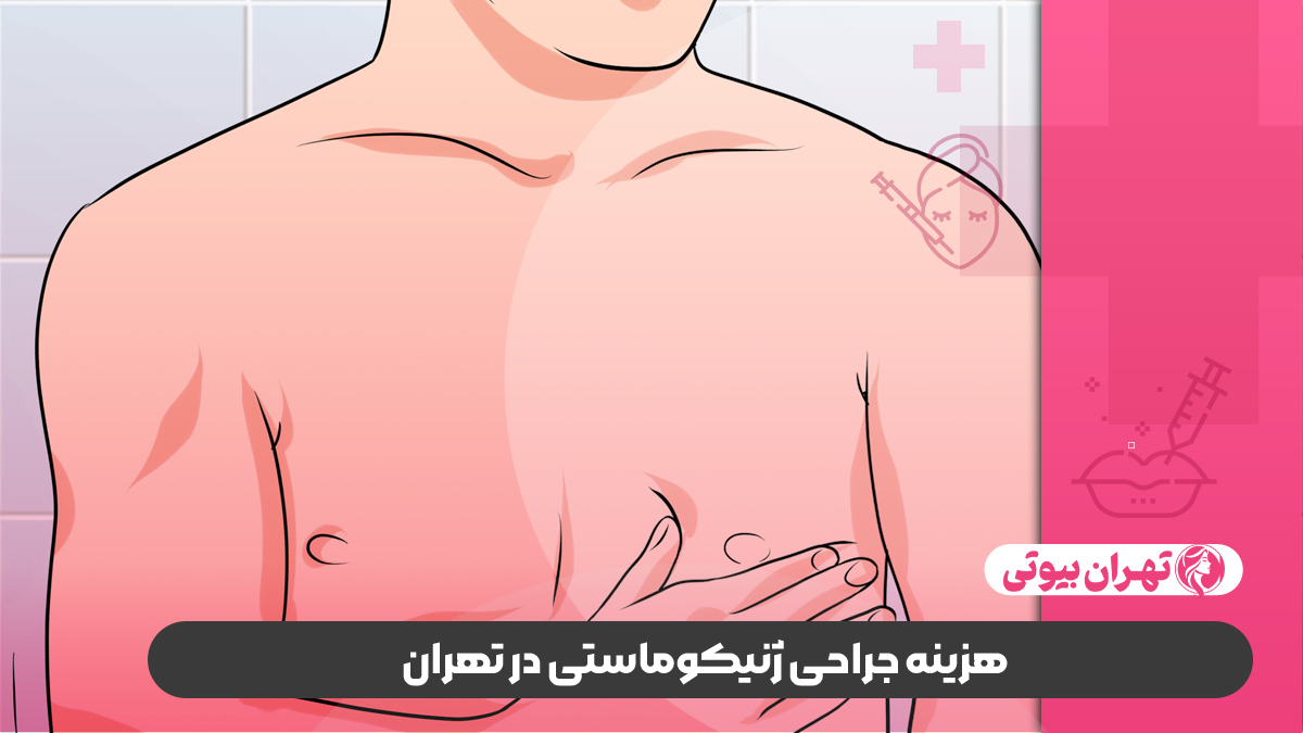 10 تا از بهترین دکتر ژنیکوماستی در تهران (جراحی کوچک کردن سینه مردان)