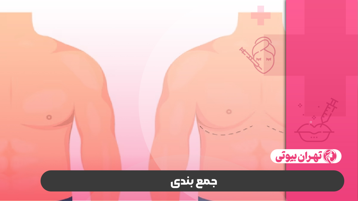10 تا از بهترین دکتر ژنیکوماستی در تهران (جراحی کوچک کردن سینه مردان)