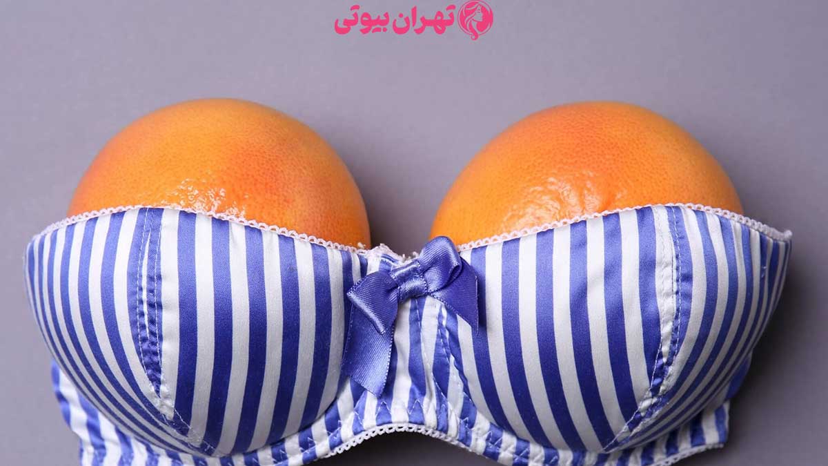 10 بهترین دکتر لیفت سینه در تهران