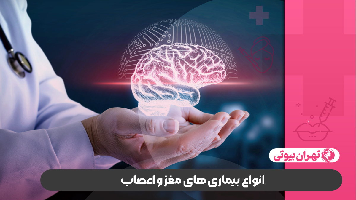10 بهترین متخصص مغز و اعصاب در تهران