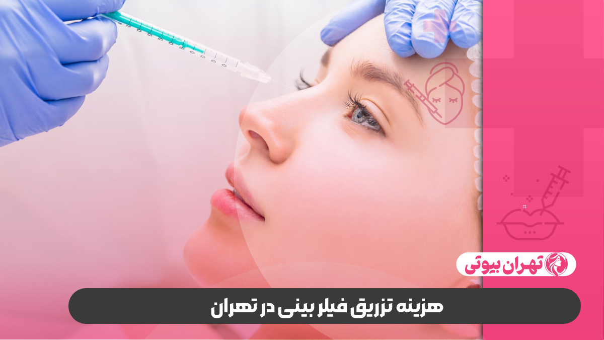 10 بهترین دکتر تزریق فیلر بینی در تهران