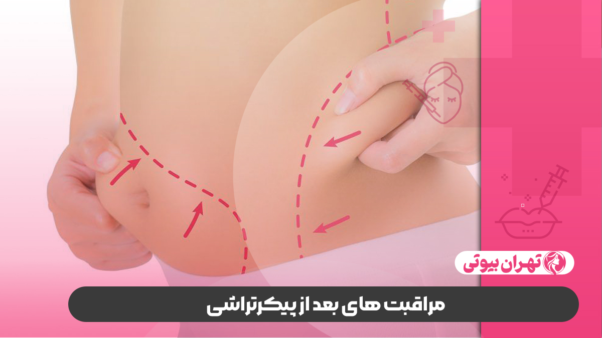 10 بهترین دکتر پیکر تراشی در تهران