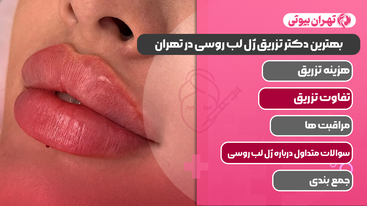 10 بهترین دکتر تزریق ژل لب روسی در تهران