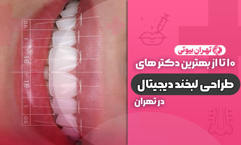 10 بهترین دکتر طراحی لبخند دیجیتال در تهران