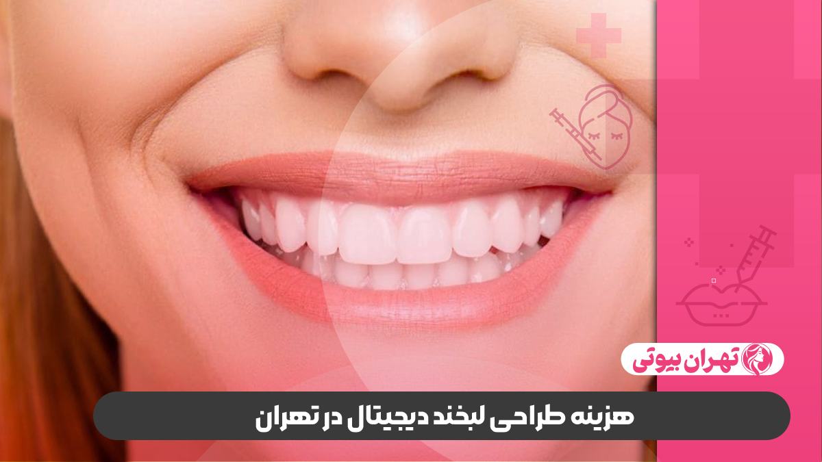 10 بهترین دکتر طراحی لبخند دیجیتال در تهران