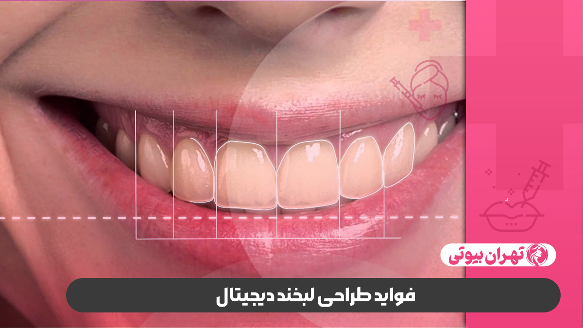 10 بهترین دکتر طراحی لبخند دیجیتال در تهران