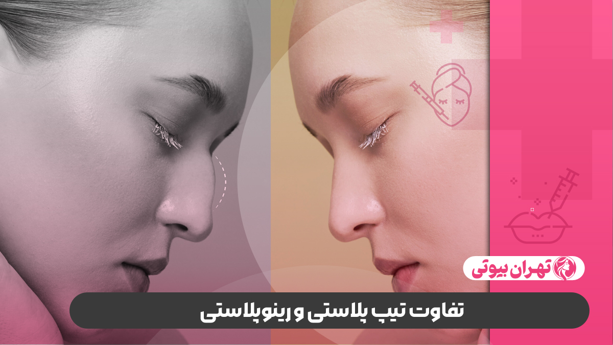 10 بهترین دکتر تیپ پلاستی در تهران