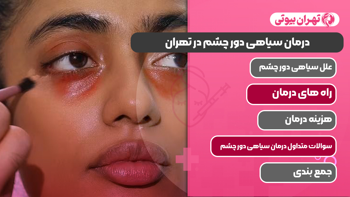 10 بهترین دکتر درمان سیاهی دور چشم در تهران