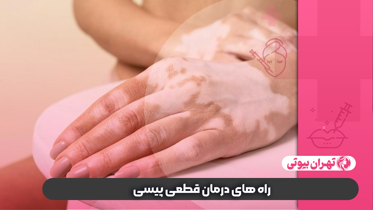 10 بهترین دکتر درمان قطعی پیسی در تهران (ویتیلیگو)