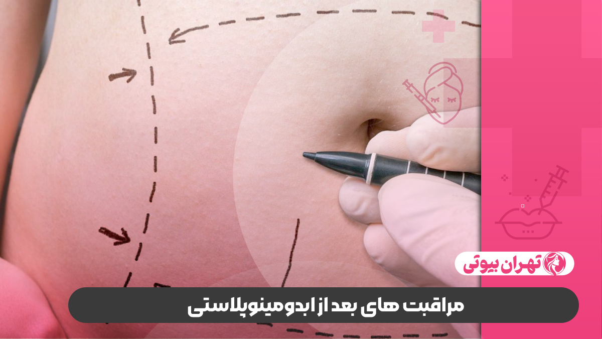 10 بهترین دکتر ابدومینوپلاستی در تهران