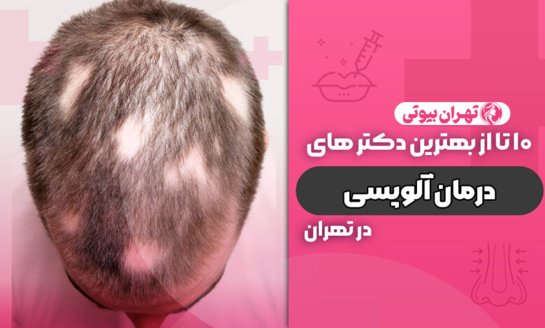 10 بهترین دکتر درمان آلوپسی در تهران