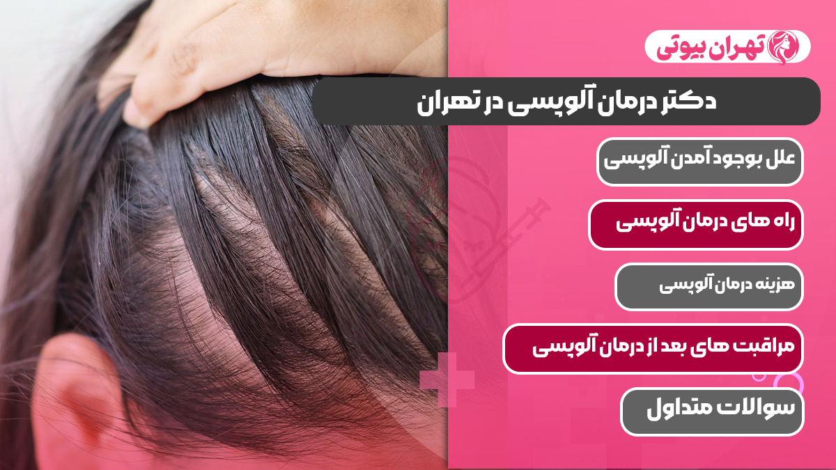 10 بهترین دکتر درمان آلوپسی در تهران
