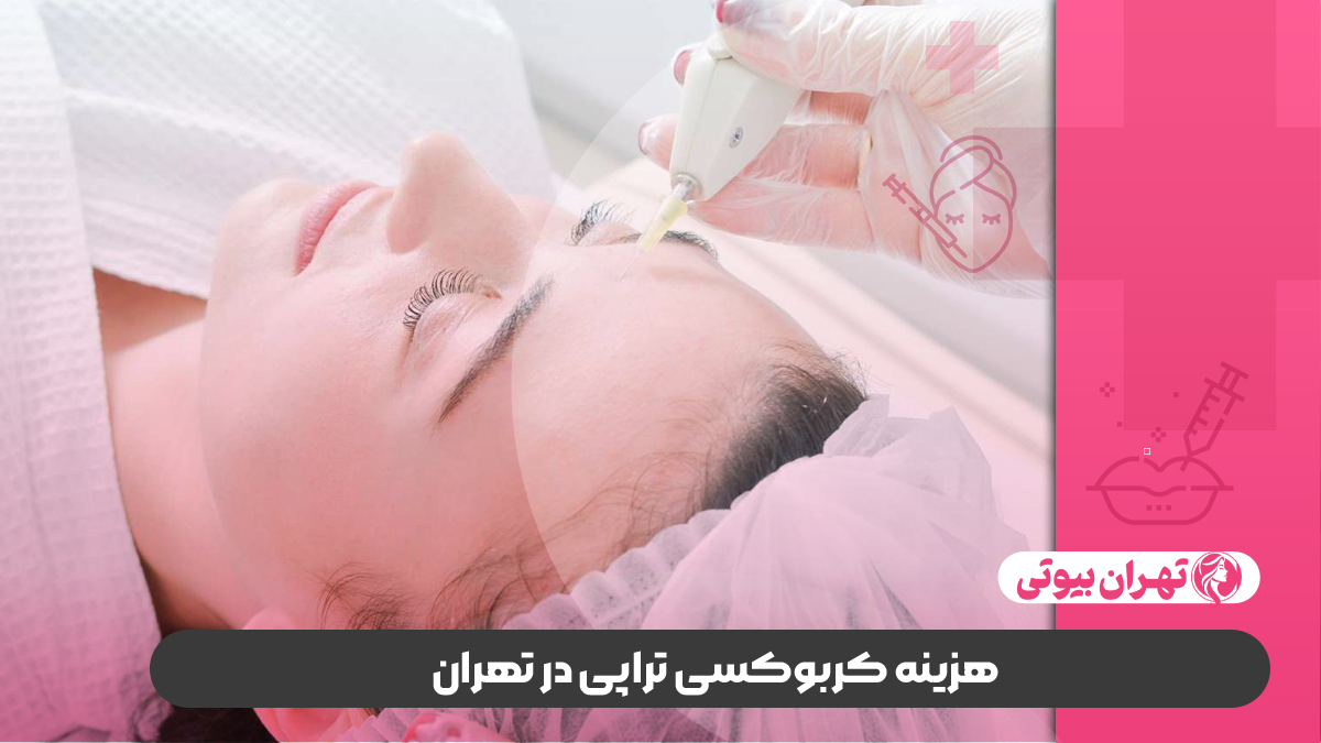 10 بهترین مرکز کربوکسی تراپی در تهران