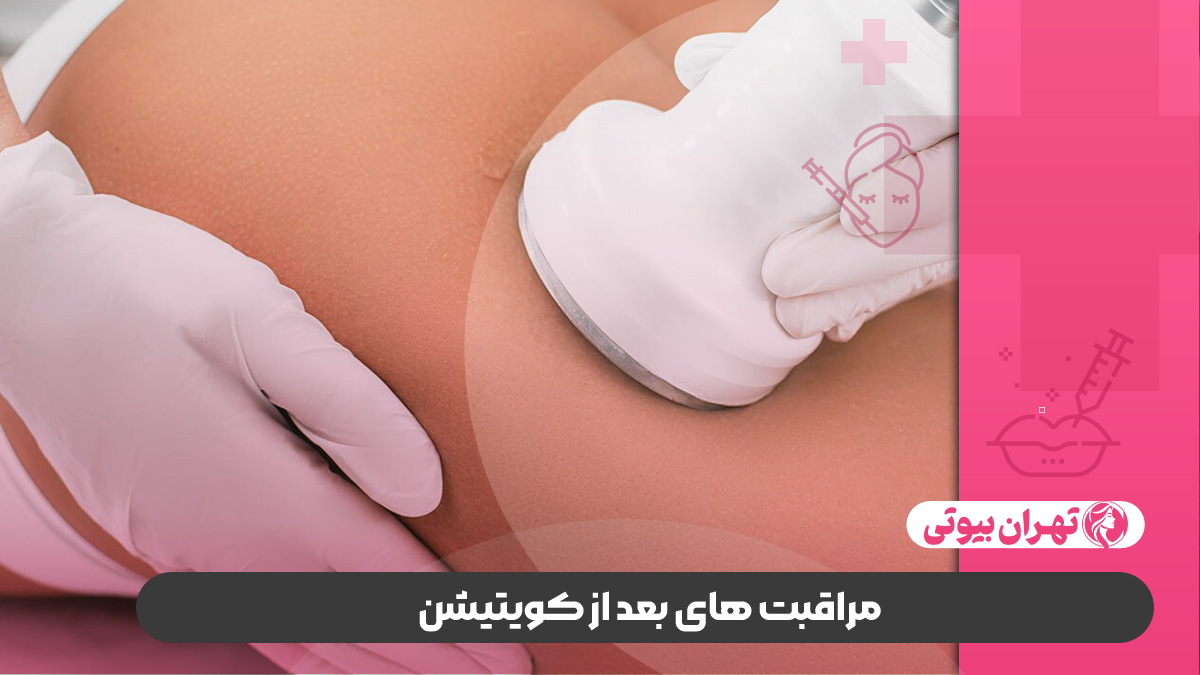 10 بهترین مرکز کویتیشن در تهران