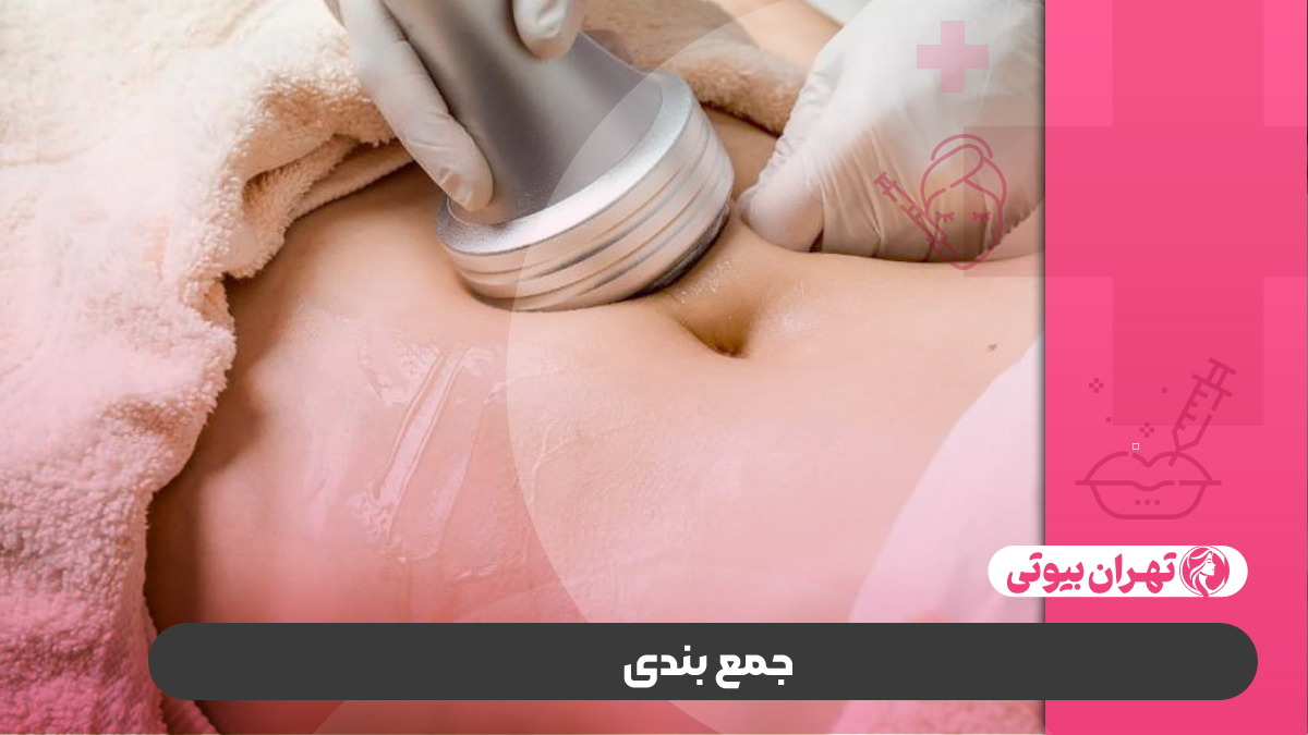 10 بهترین مرکز کویتیشن در تهران