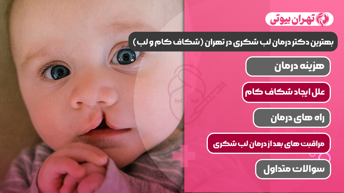10 بهترین دکتر درمان لب شکری در تهران (شکاف کام و لب)