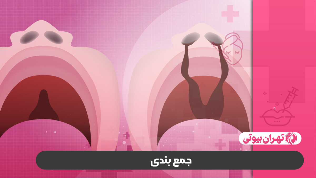 10 بهترین دکتر درمان لب شکری در تهران (شکاف کام و لب)