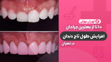 10 بهترین متخصص افزایش طول تاج دندان در تهران